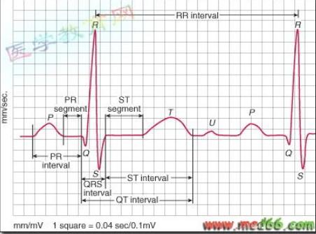 简易心电图教程