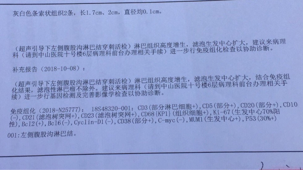 左腹股沟下有一不痛的淋巴结肿块约鸽子蛋大