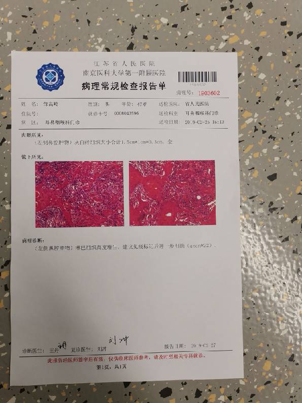 疑似淋巴瘤,在等免疫组化,有大神能帮忙看一下病理结.