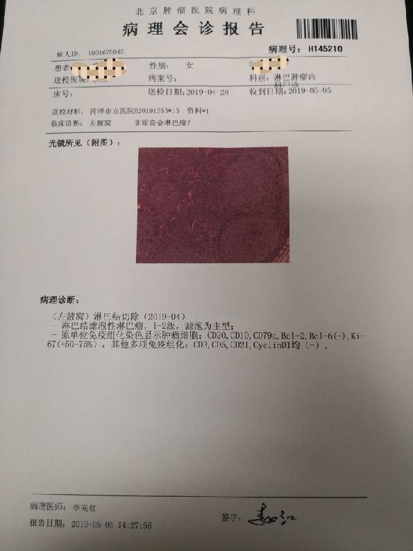 两个病理报告麻烦大神们给看一下谢谢