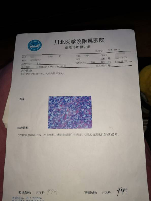 经典霍奇金淋巴瘤结节硬化型拜托各位大神看看严不严重属于几期了谢谢