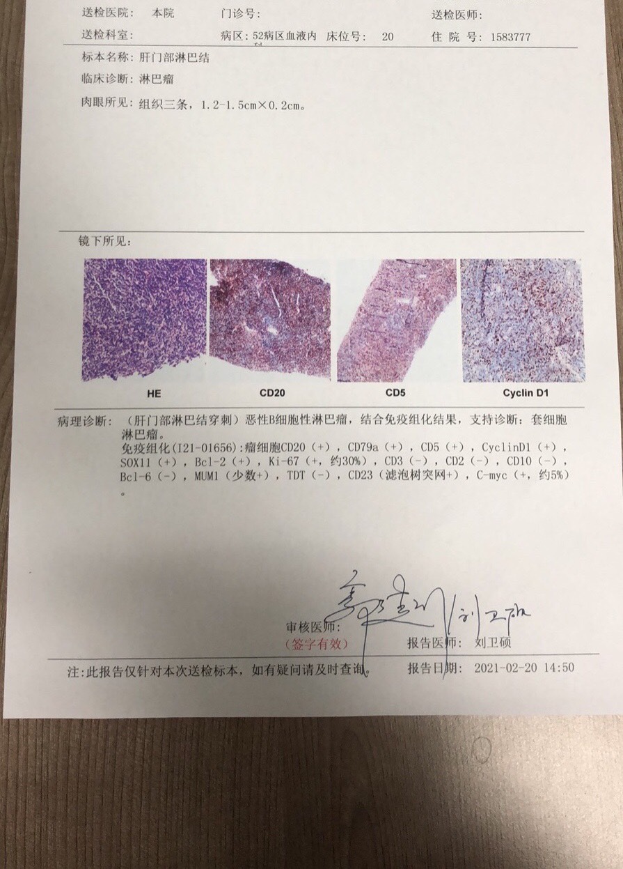 妈妈被确诊为套细胞淋巴瘤,还有希望吗?